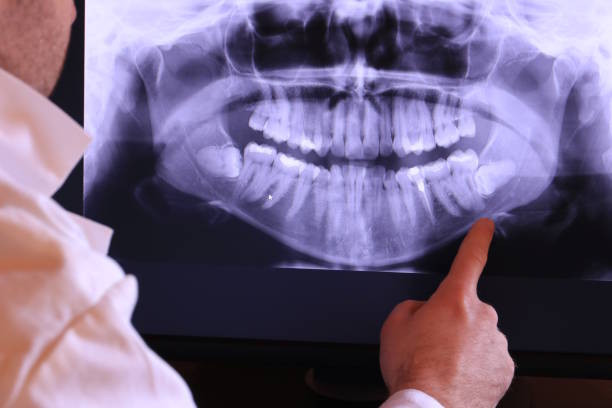 Best Emergency Dental Care for Abscessed Tooth in Stony Point, MI
