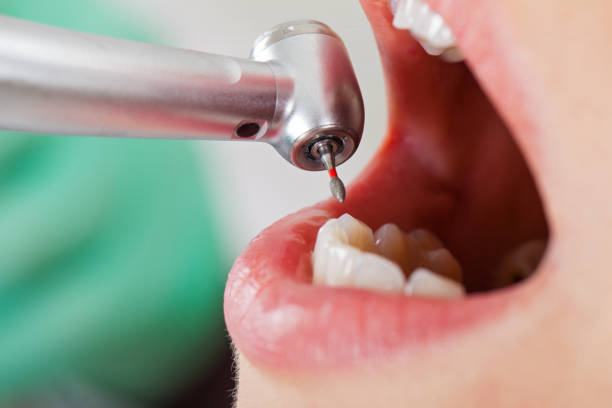 Best Orthodontic Emergency Dentist in Stony Point, MI